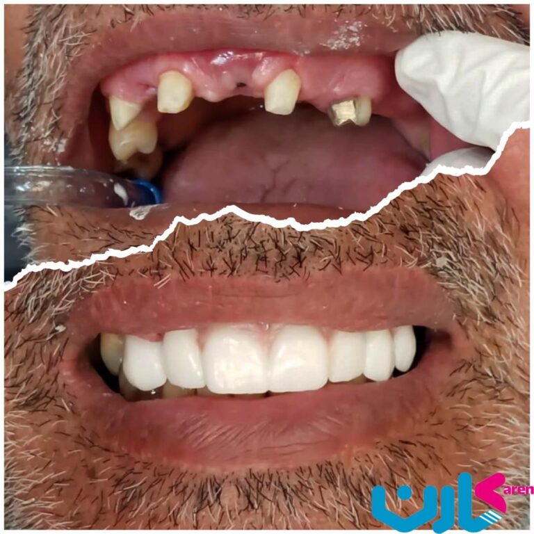 کلینیک و ایمپلنت دیجیتال کارن